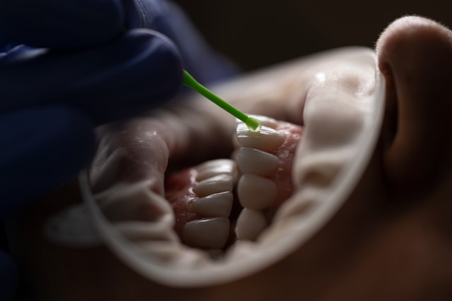 Benefits of Regular Dental Checkups for Long-Term Oral Health Benefits of Regular Dental Checkups for Long-Term Oral Health